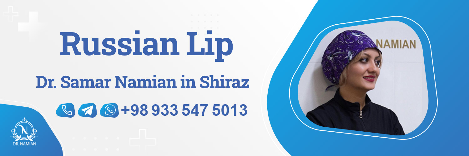 Best doctor for Russian Lip in Shiraz