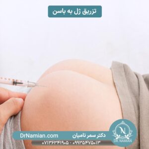 Buttock Filler Injection in Shiraz