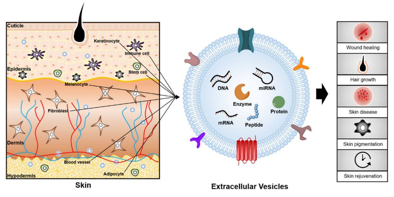 Exosomes Therapy