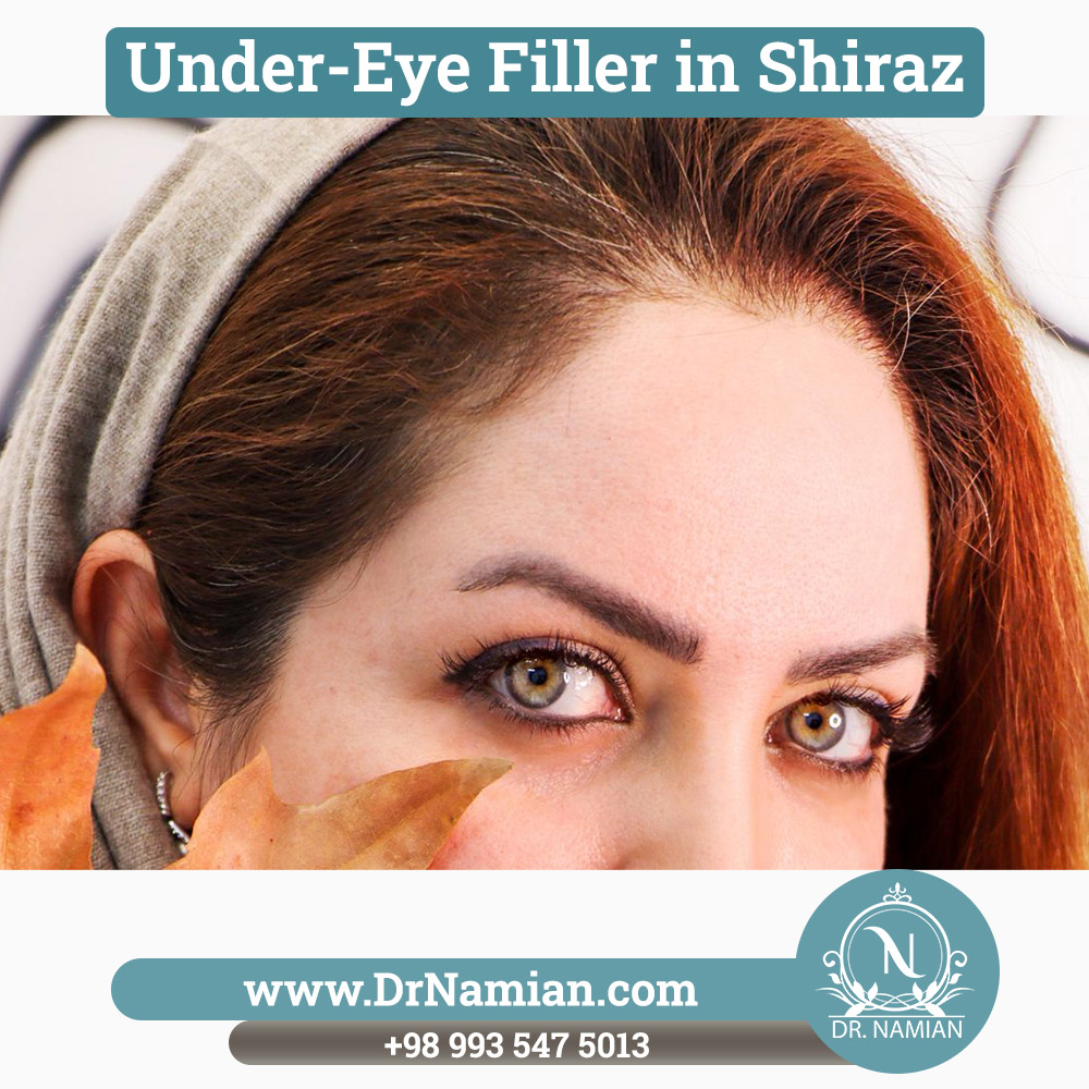 Under-Eye Fillers in Shiraz, Iran