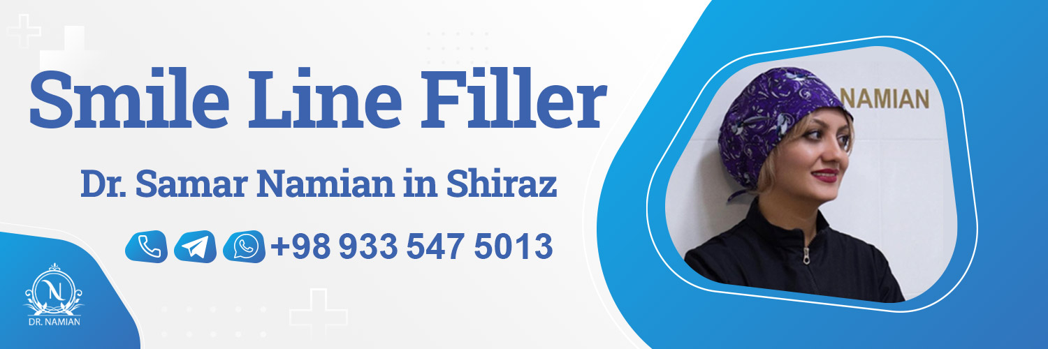 Best doctor for smile line filler in Shiraz, Iran