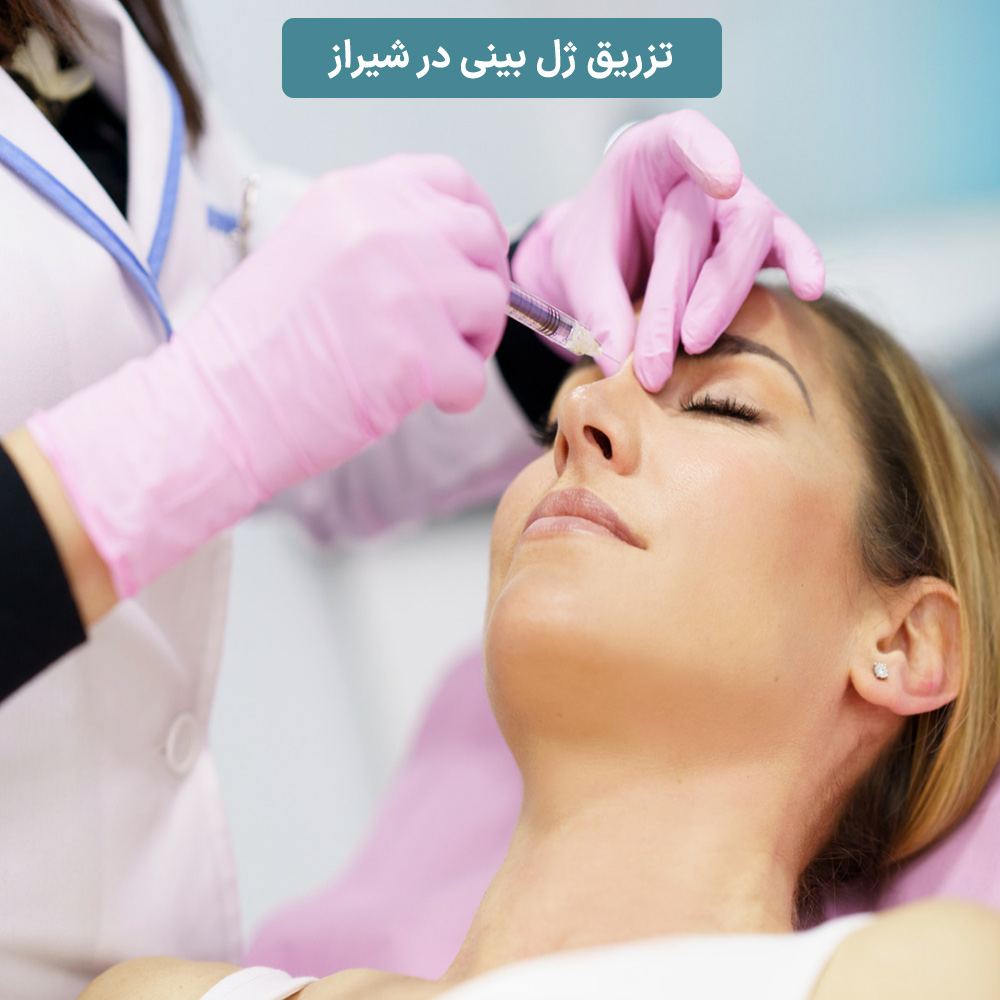 Nose Fillers: Non-Surgical Rhinoplasty in Shiraz