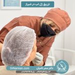 تزریق ژل لب در شیراز