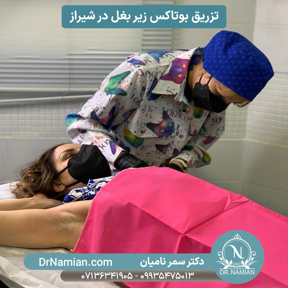تزریق بوتاکس زیر بغل در شیراز