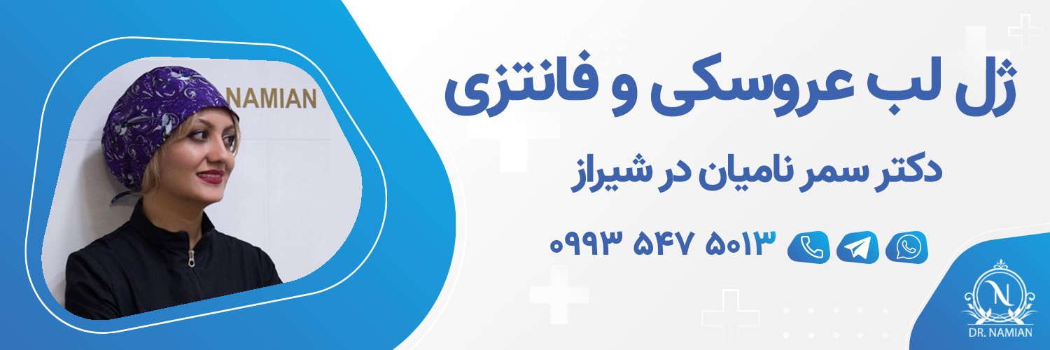 بهترین دکتر ژل لب عروسکی شیراز بهترین دکتر ژل لب عروسکی شیراز