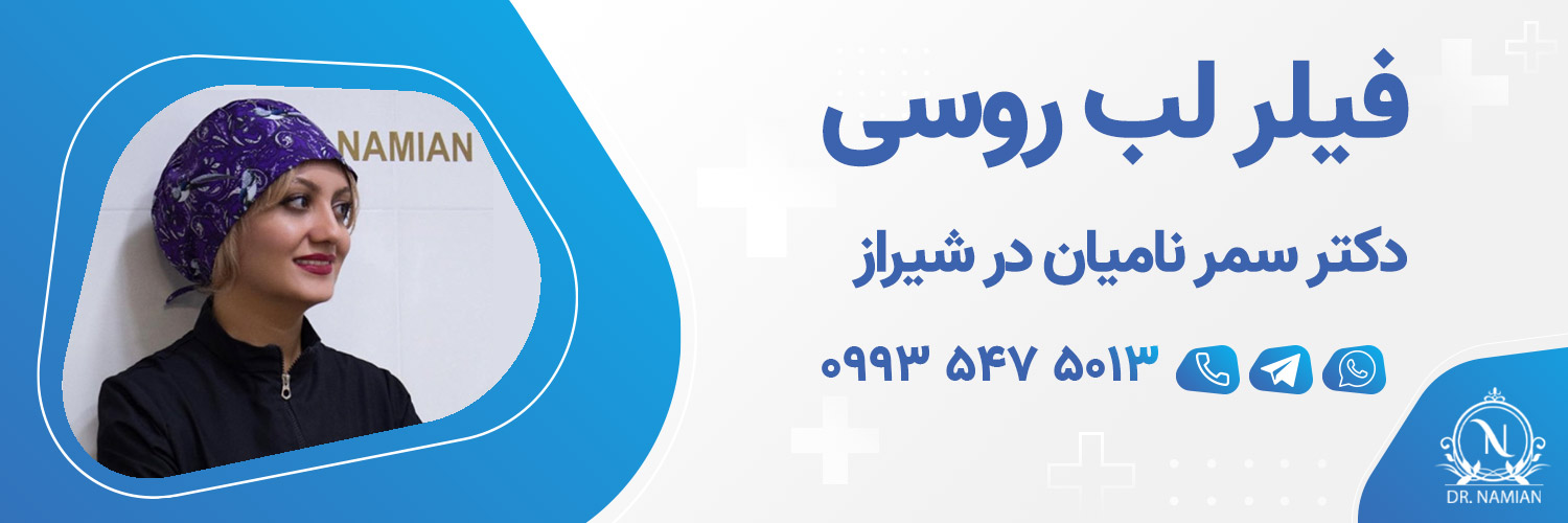 بهترین دکتر فیلر لب روسی شیراز