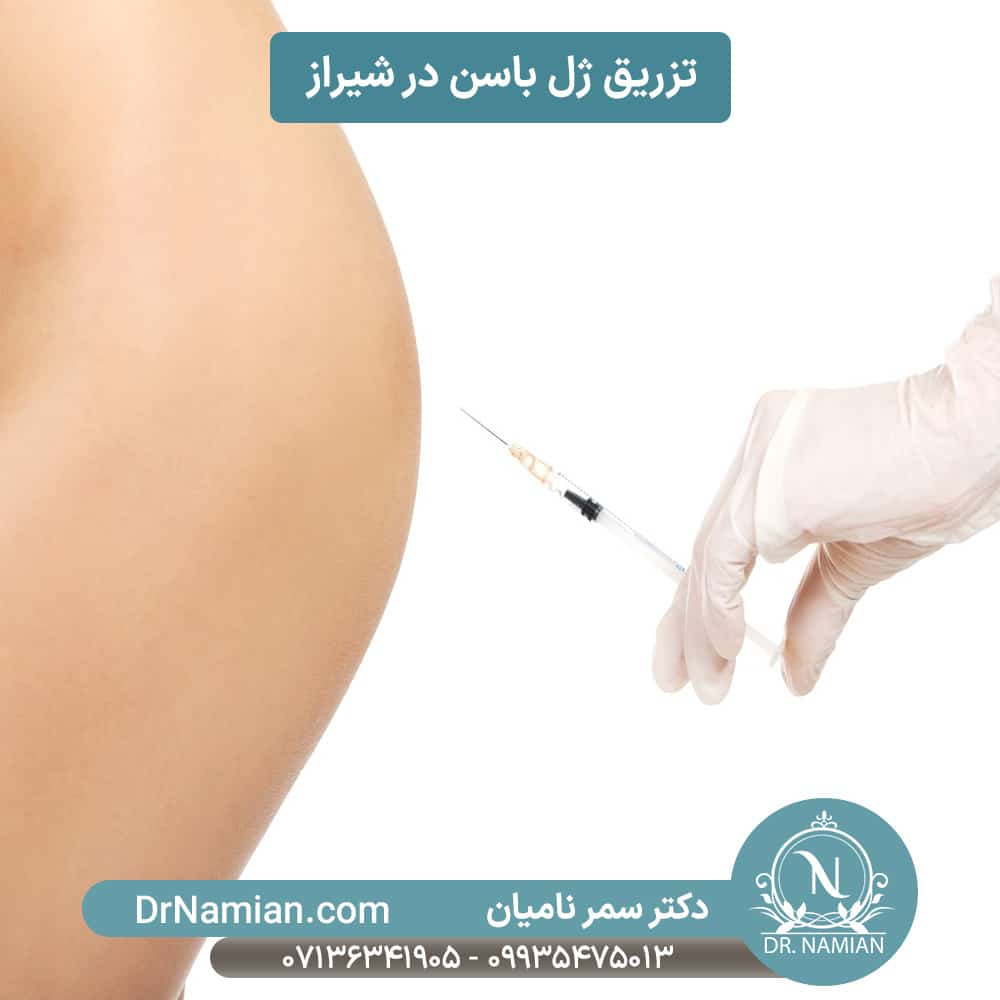 بهترین دکتر فیلر باسن شیراز بهترین دکتر فیلر باسن شیراز