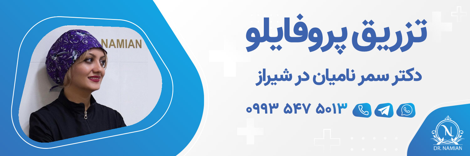 بهترین دکتر پروفایلو شیراز
