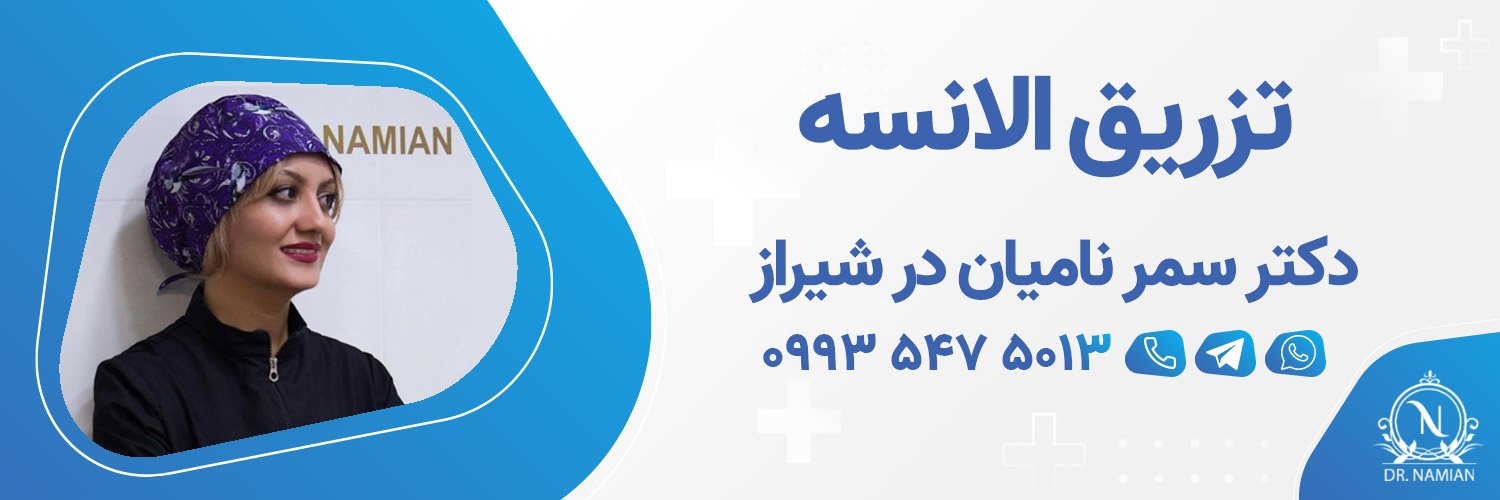 بهترین دکتر تزریق الانسه شیراز