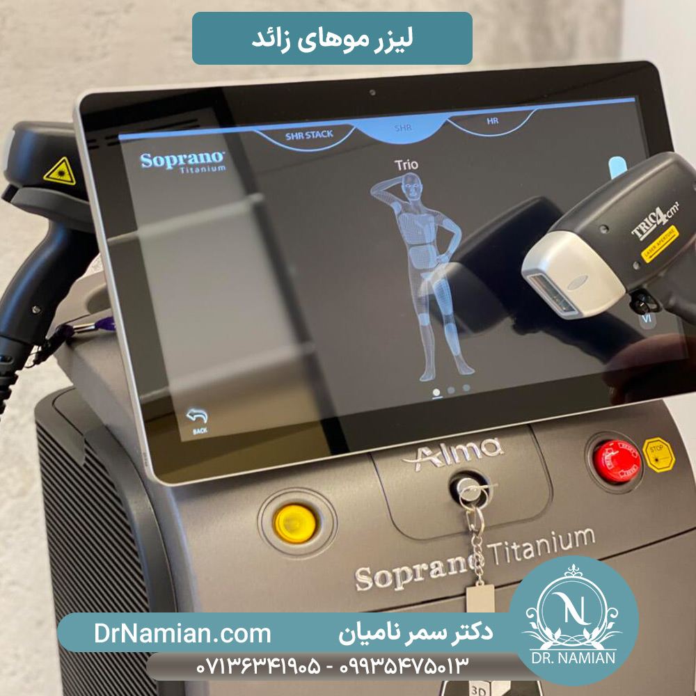 لیزر موهای زائد در شیراز