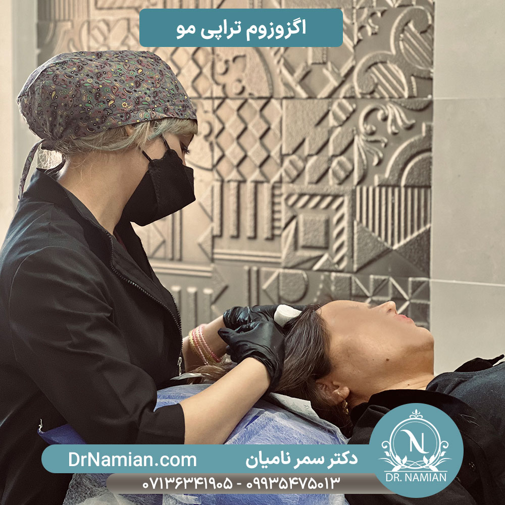 اگزوزوم مو برای تقویت و درمان ریزش مو