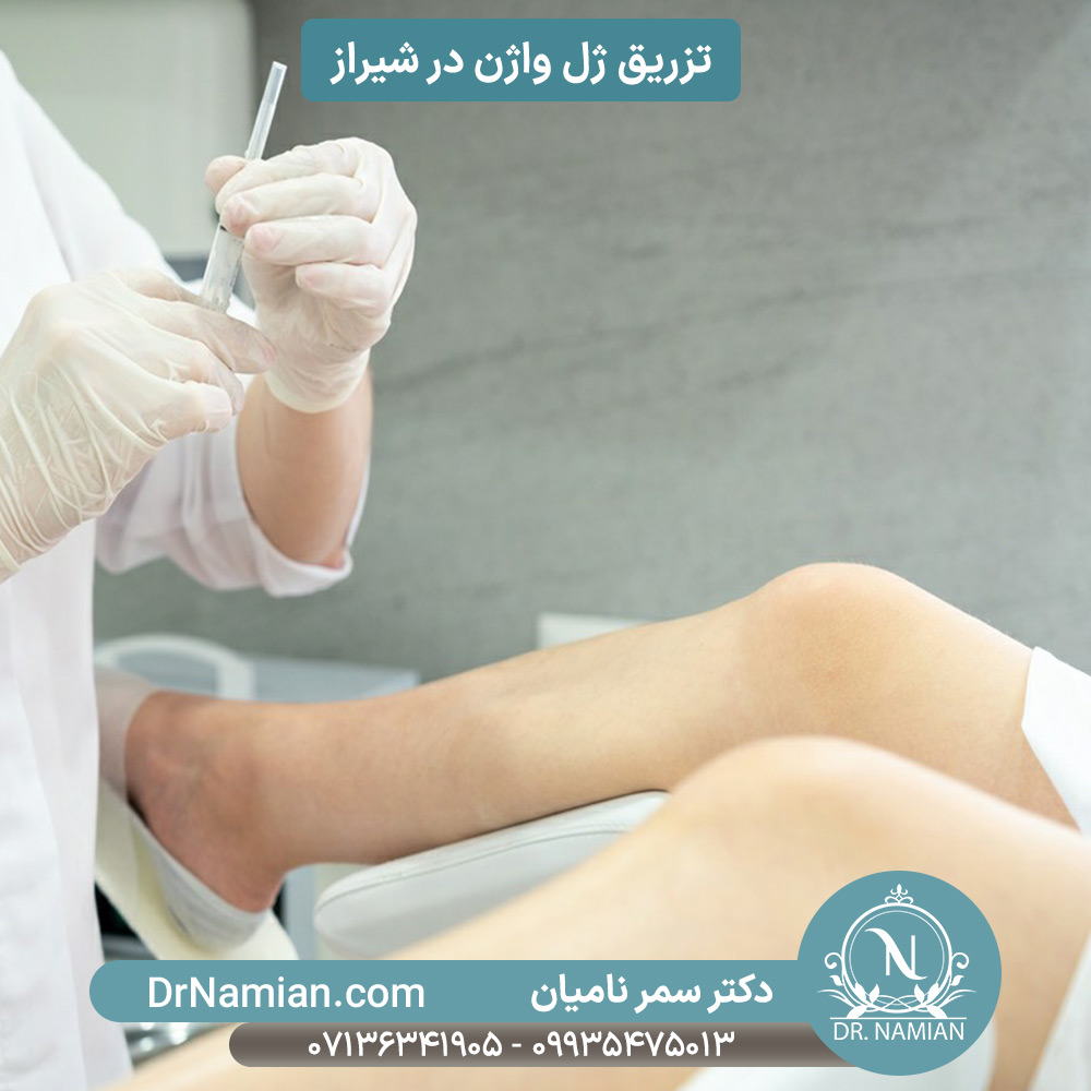 تزریق فیلر واژن در شیراز تزریق فیلر واژن در شیراز