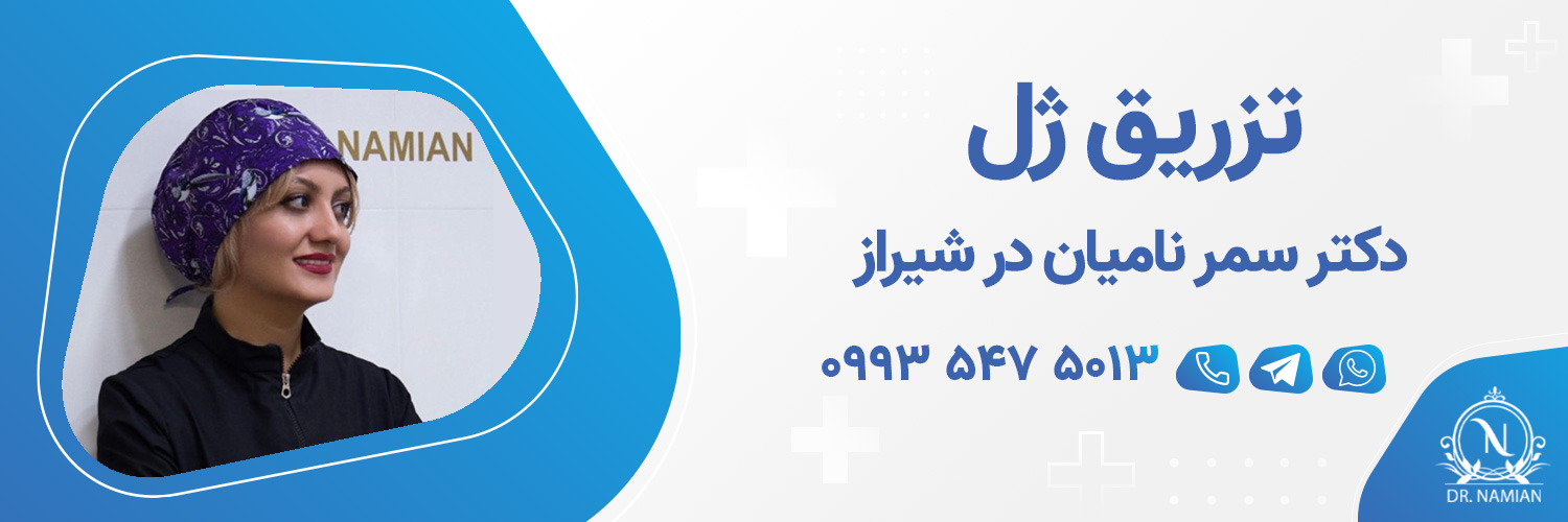 تزریق ژل در شیراز