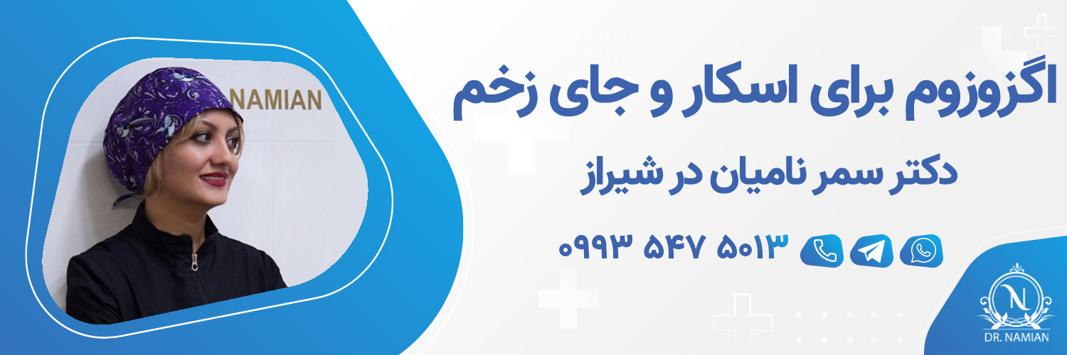 بهترین دکتر اگزوزوم برای درمان اسکار و جای زخم در شیراز بهترین دکتر اگزوزوم برای درمان اسکار و جای زخم در شیراز