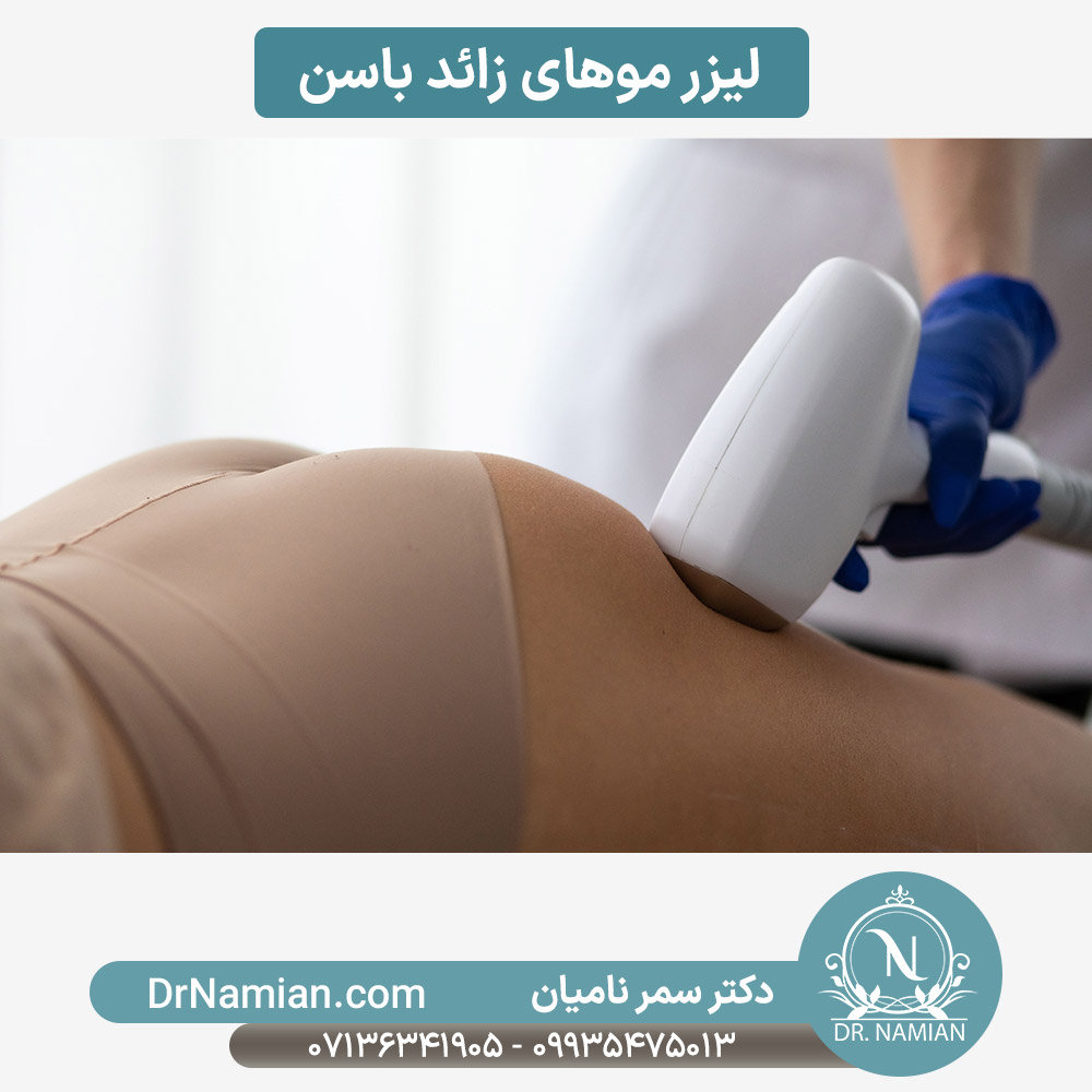 لیزر مو باسن در معالی آباد شیراز لیزر مو باسن در معالی آباد شیراز