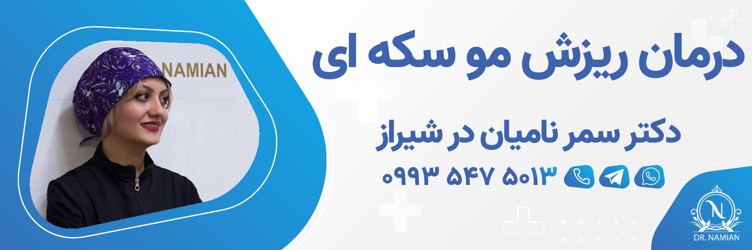بهترین دکتر درمان ریزش مو سکه ای در شیراز